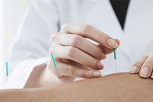 Awaken Chiropractic provides dry needling therapy in Parker, CO