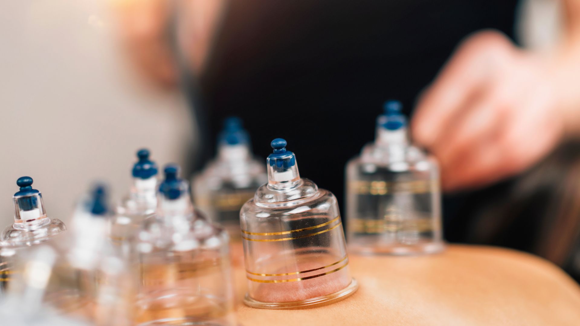medical cupping therapy